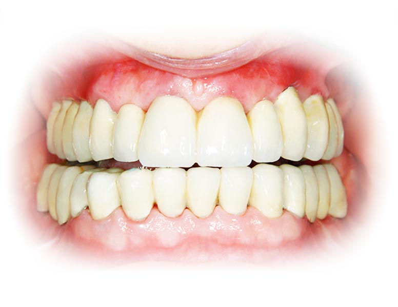 Tandenservice bij tandarts
